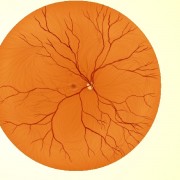 diagram_of_retina