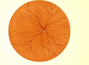 diagram of retina