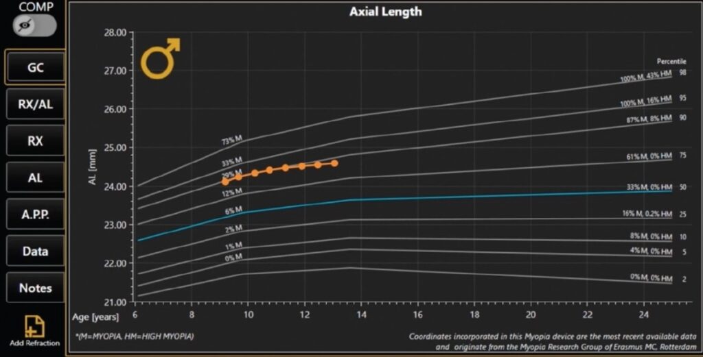 Axial length measurement for myopia management – eyesight test price for children in Winnipeg